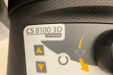 3D CT Scan at Designer Smiles, FL