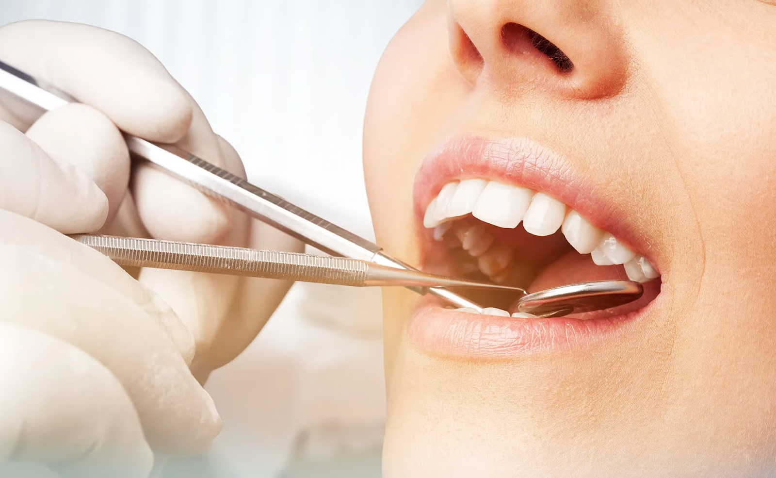 Dental cleaning in Coral Springs showing professional teeth cleaning procedure and oral care treatment