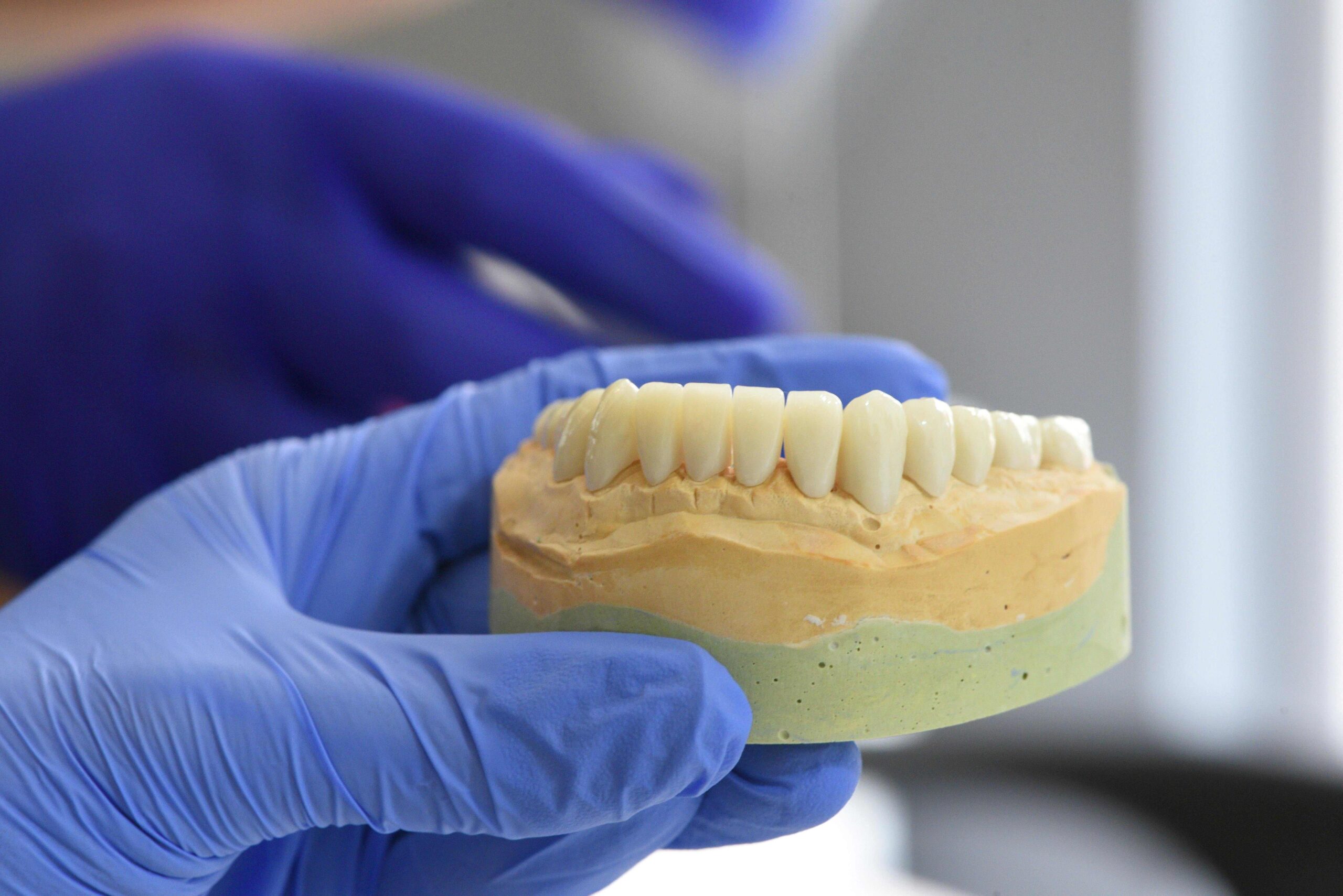 Dental Implant Specialist Accepting Insurance Coral Springs: What Patients Need to Know in 2026