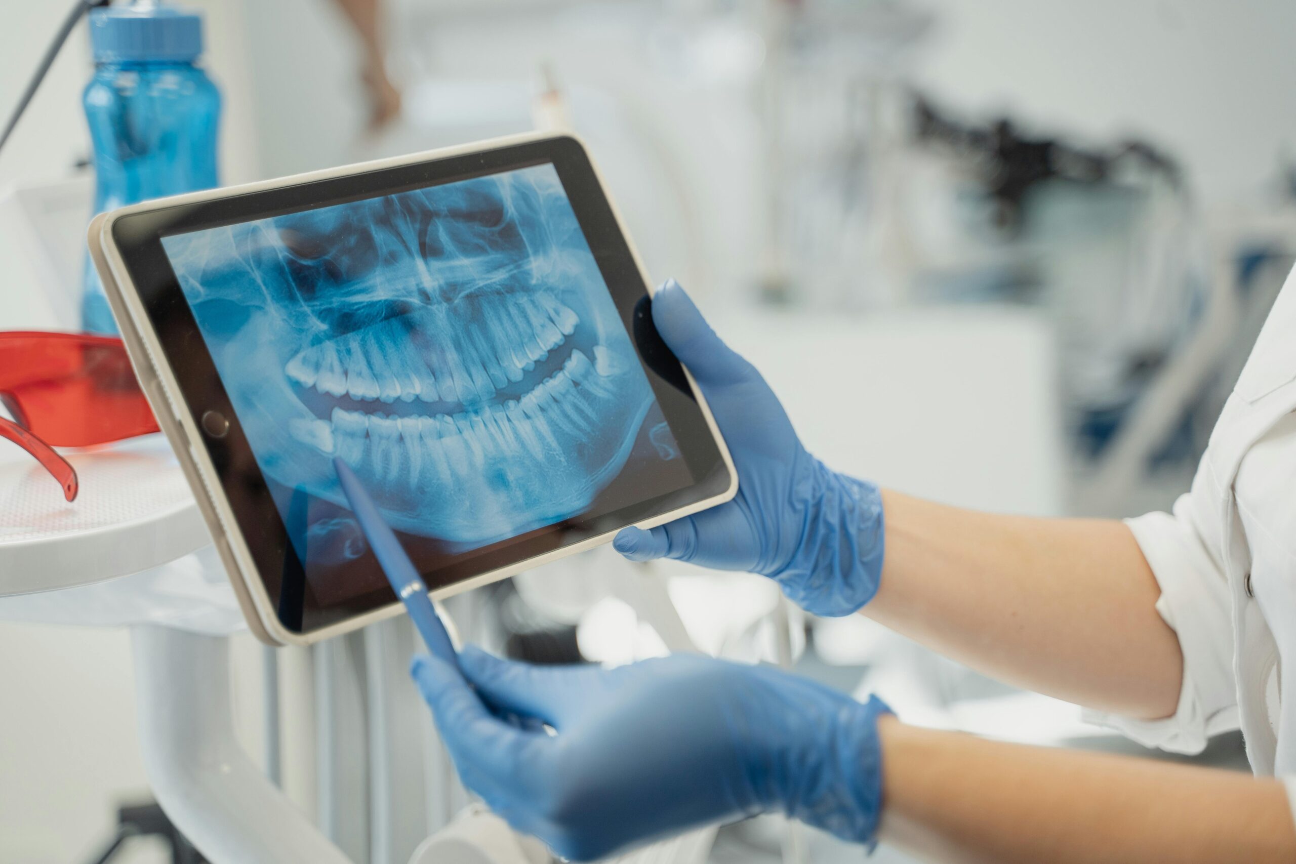 Teledentistry for Periodontal Care in Coral Springs: A Convenient First Step Toward Healthier Gums
